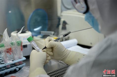 诺如病毒II型核酸检测试剂盒-上海创坤生物科技有限公司