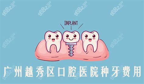 广州越秀区口腔医院种牙费用比起增城区的来说哪个更心动,种植牙-8682赴韩整形网