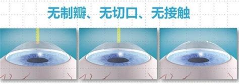 phloem fiber 的图像结果