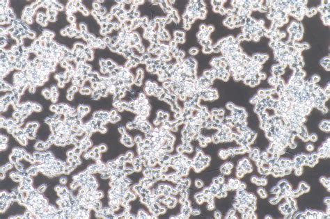 HUVEC 人脐静脉内皮细胞永生化-原代细胞-STR细胞-细胞培养基-镜像绮点生物