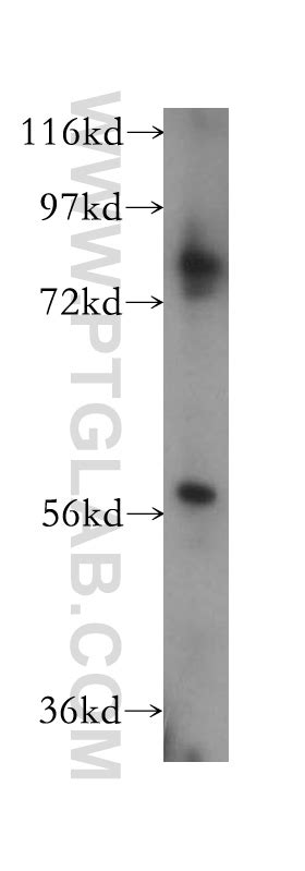 CYP19A1 Antibody 16554-1-AP | Proteintech