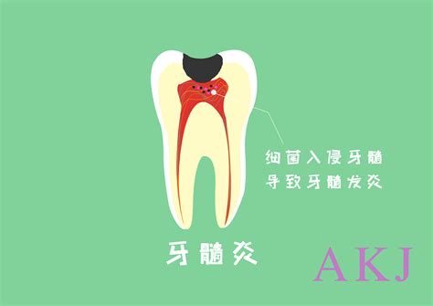 智齿发炎图片