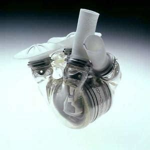 人工心脏起搏器的主要组成部分