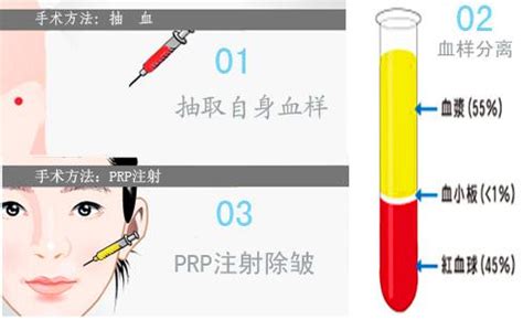 prp自体血清美容是什么原理？ - 知乎