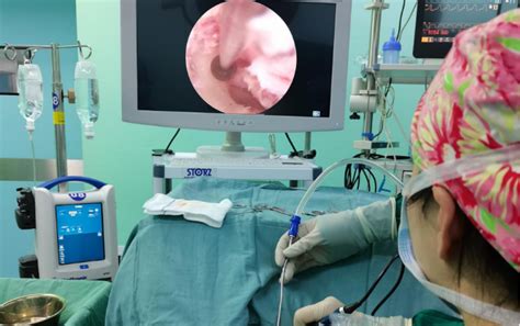 耳鼻咽喉头颈外科成功开展首例持续灌流模式下耳内镜手术-陕西省人民医院五官病院
