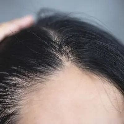头发细软怎么改善变粗 如何改善头发细软_三思经验网