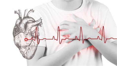 心肌梗塞的早期表现并不是只有胸痛，这几种现象也应警惕 - 知乎