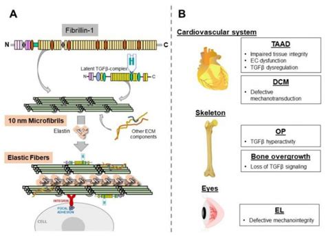 【案例分享】心血管-马凡综合征-FBN1基因 - 知乎