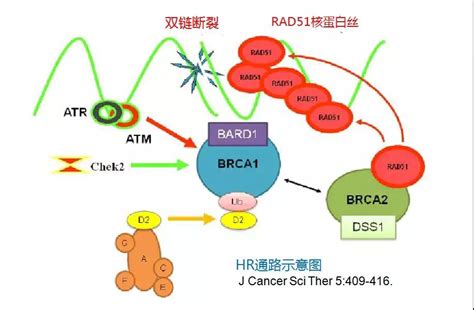 Eur Urol︱BRCA 1/2和ATM突变状态与前列腺癌主动监测的再分级相关-肿瘤瞭望