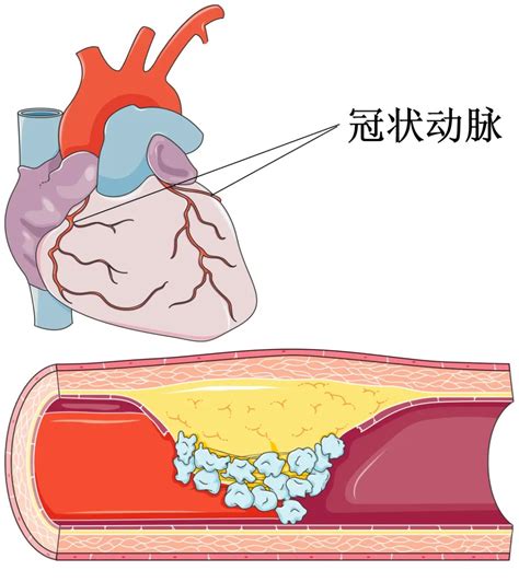 人体心脏血管场景图片素材-正版创意图片401789446-摄图网
