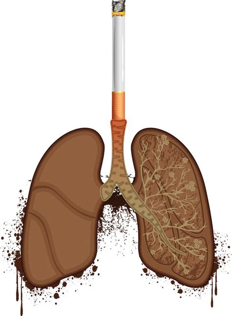 吸烟的人，出现4个异常，或说明肺“变黑”了，占一个，也要养肺|吸烟|肺部|养肺_新浪新闻