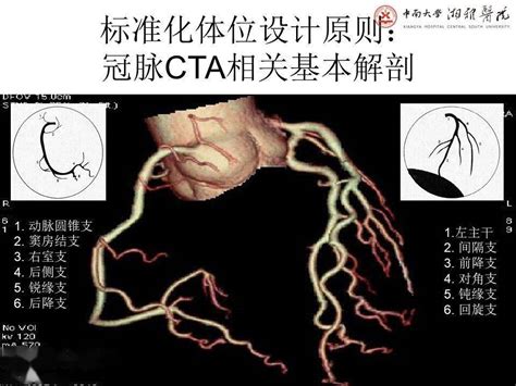 冠脉及胸痛三联CTA重建规范及报告模板_医学界-助力医生临床决策和职业成长