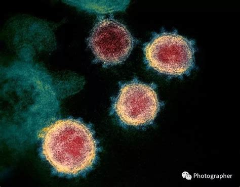 新型冠状病毒潜伏期发病期时间有多长 - 育儿知识