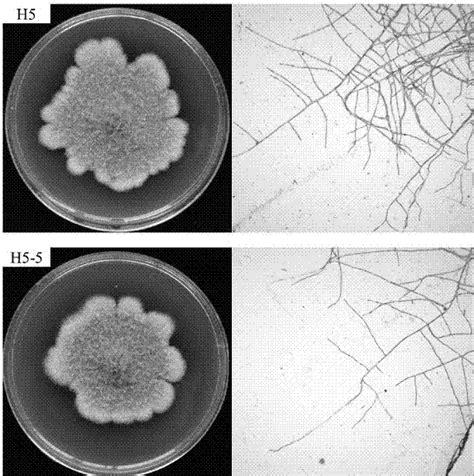 一种农杆菌介导的黑附球菌遗传转化方法及转化子菌株与流程