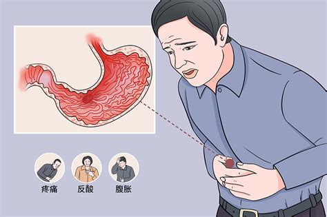 胃炎疼痛位置图图片