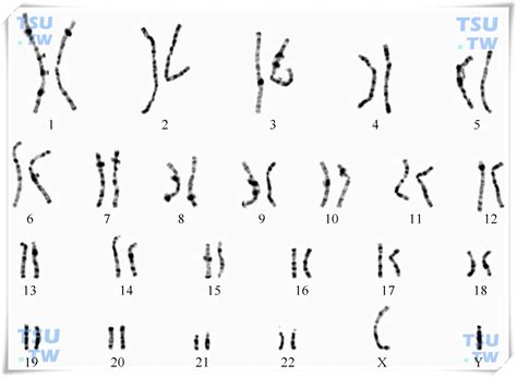 人类染色体和染色体异常 - 男科学 - 天山医学院
