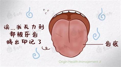 湿气重的舌头图片