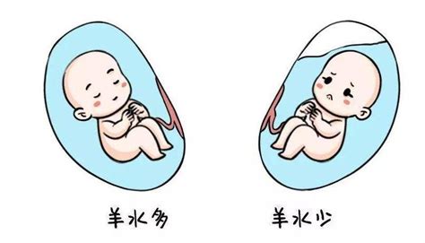 怎样判定胎儿缺氧_b超判定胎儿缺氧 - 随意云
