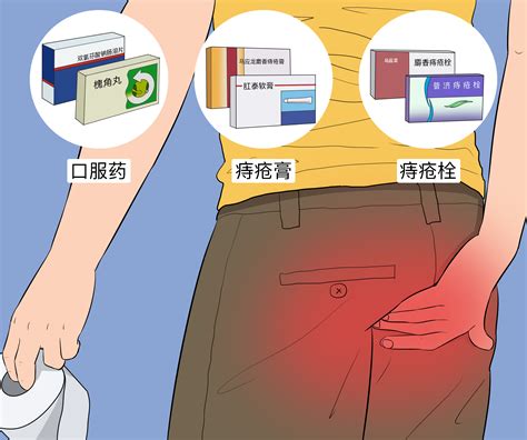 十人九痔作为一个曾经的患者_[标签:标题1]