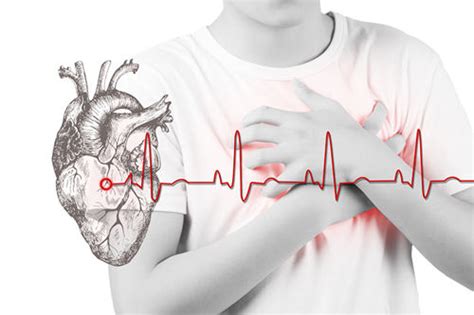 心肌缺血是怎么造成的 心肌缺血的原因_查查吧