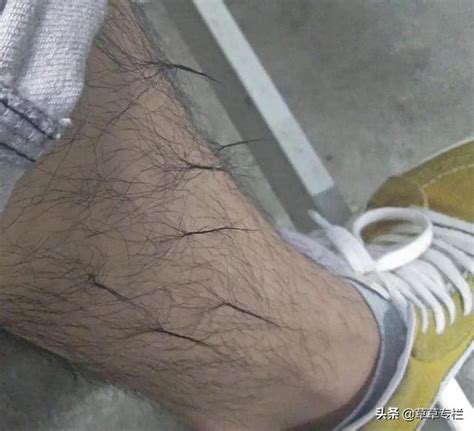 毛的图片