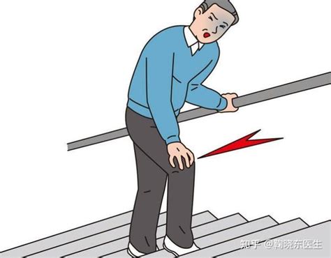 上下楼梯痛，一按就痛，这是膝关节发出的求救信号 - 知乎