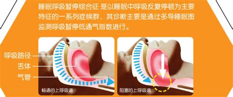 呼噜小精灵第5季演员