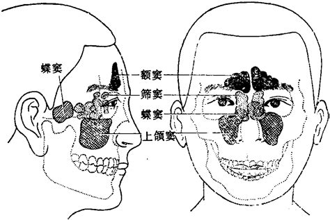 图177 鼻旁窦的位置-基础医学-医学