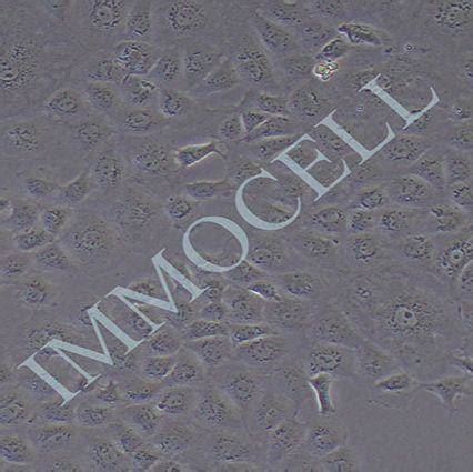 MPC-5小鼠肾足细胞丨MPC5细胞系丨逸漠(immocell)价格,详情介绍-960化工网 – 960化工网