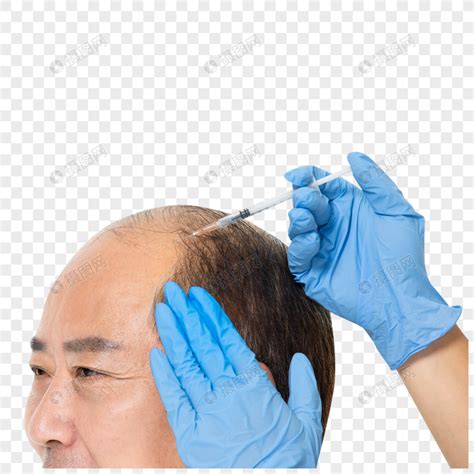 为什么医学生强烈建议脱发严重秃头用育发液，3个月蜕变“发量王者”真的那么猛？ - 知乎