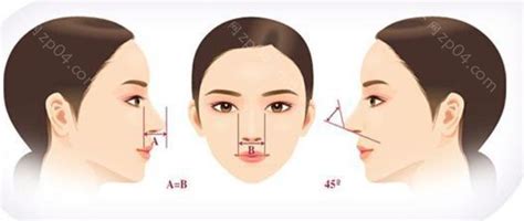 韩国隆鼻整形手术哪家好?歌柔飞整形3D打印隆鼻技术挺赞,隆鼻-8682赴韩整形网