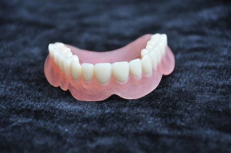 种植覆盖义齿（全口）一例---牙医风涛-商丘牙医-靳风涛-的博客-KQ88口腔博客