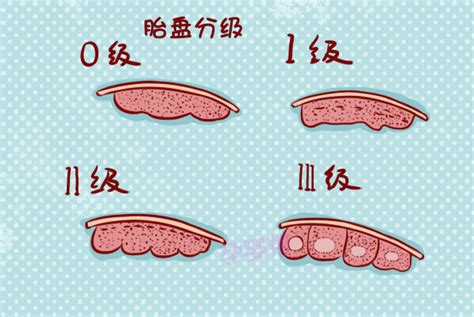 孕23周胎盘成熟1级什么意思？最详细的胎盘分析全在这里