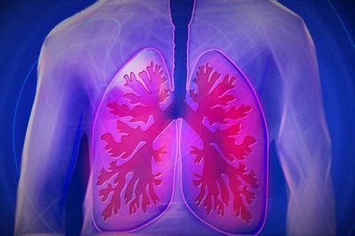 肺癌患者以及家属须知的肺癌晚期症状-康安途海外医疗