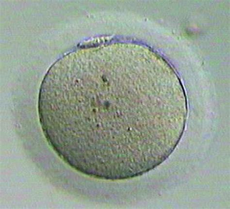 图2-12 MⅡ期卵子-基础医学-医学