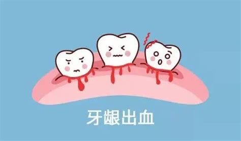 刷牙牙齿出血怎么回事（刷牙时牙龈出血怎么办？这与3个疾病有关，别满不在乎！） | 说明书网