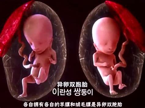 不说不知道，生命真奇妙，双胞胎的第三种形成方式，“半同卵双胞”基因相似度89%
