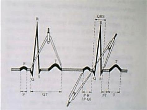 例图149-临床心电图学及-医学