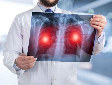 你的肺还好吗？看看这5个标准，可自查，方法简单_肺部
