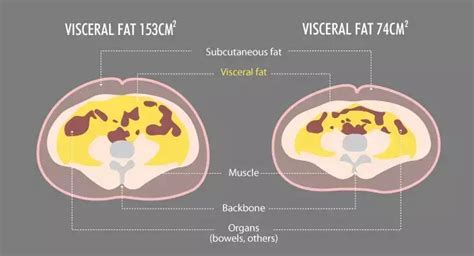 内脏脂肪超高严重，如何短期内减掉内脏脂肪并提高基础代谢率？ - 知乎