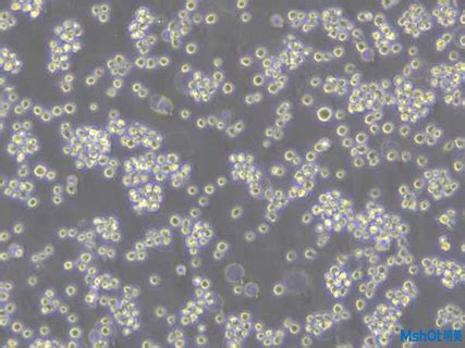 倒置荧光显微镜应用于活细胞生长状况以及蛋白质荧光转染效率观察-明美光电