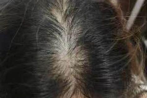 头发稀少怎么办最快恢复（头发少、还老是掉头发？要听话做好这4件事，别淘气） | 说明书网