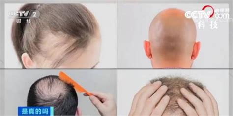 人到中年一天掉多少根头发算脱发？科学这样解释_手机新浪网