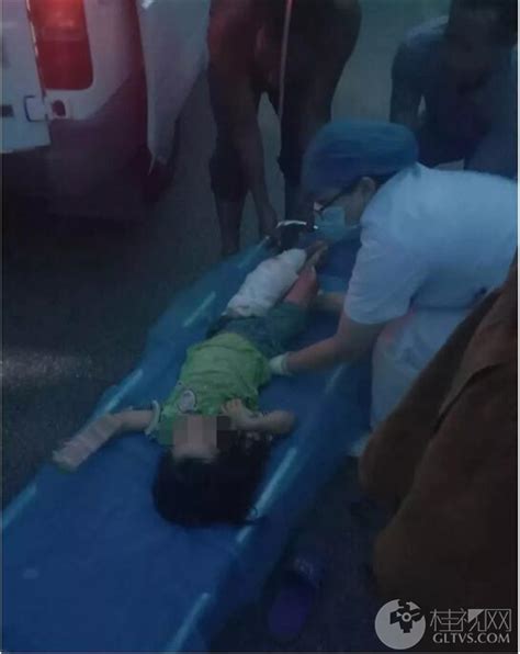 扩散 | 桂林5岁小女孩被撞左腿血肉模糊，肇事者竟当场驾车逃逸,桂视网,桂林视频新闻门户网站
