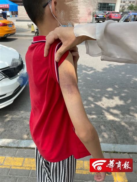 西安11岁男孩遭辅导班老师殴打全身多处淤青 警方介入调查|西安市_新浪新闻