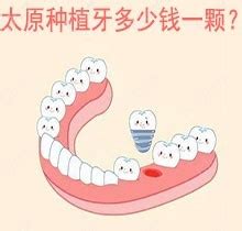 赣州种植牙多少钱一颗？都包含了种牙的哪些费用,牙齿修复-8682赴韩整形网