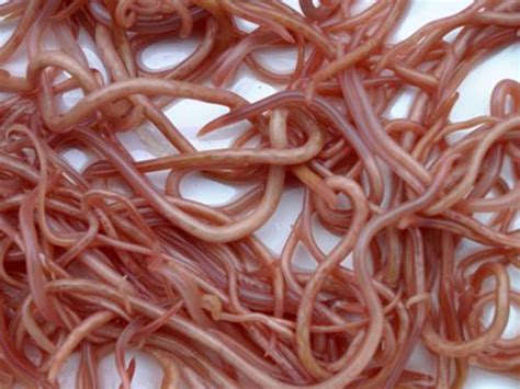 儿童肠道寄生虫图片怎么判断小孩需要打虫2022已更新今日更新