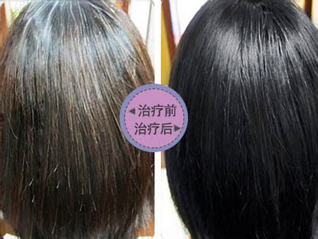 【图】治疗白发变黑发有效的方法 有什么需要注意的(2)_伊秀美容网|yxlady.com