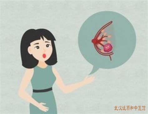 乳腺结节是什么，是癌吗？-健康科普-护理天地-太和县人民医院