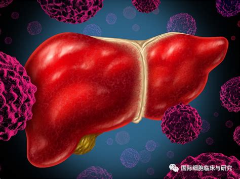 乏血供肝细胞肝癌1例——影像学的肝癌进展-医联